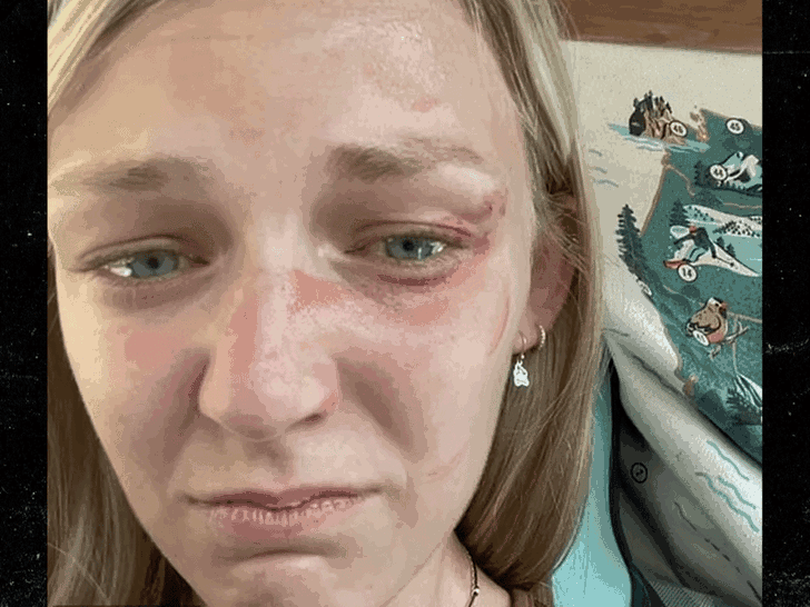 Gabby Petito's Parents Drop Selfie Showing Bruised Face Pre-Traffic Stop